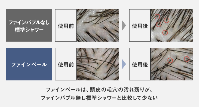 ファインバブル無し標準シャワーとファインベールでの頭皮汚れの比較画像 ファインベールは、頭皮の毛穴の汚れ残りが、ファインバブル無し標準シャワーと比較して少ない