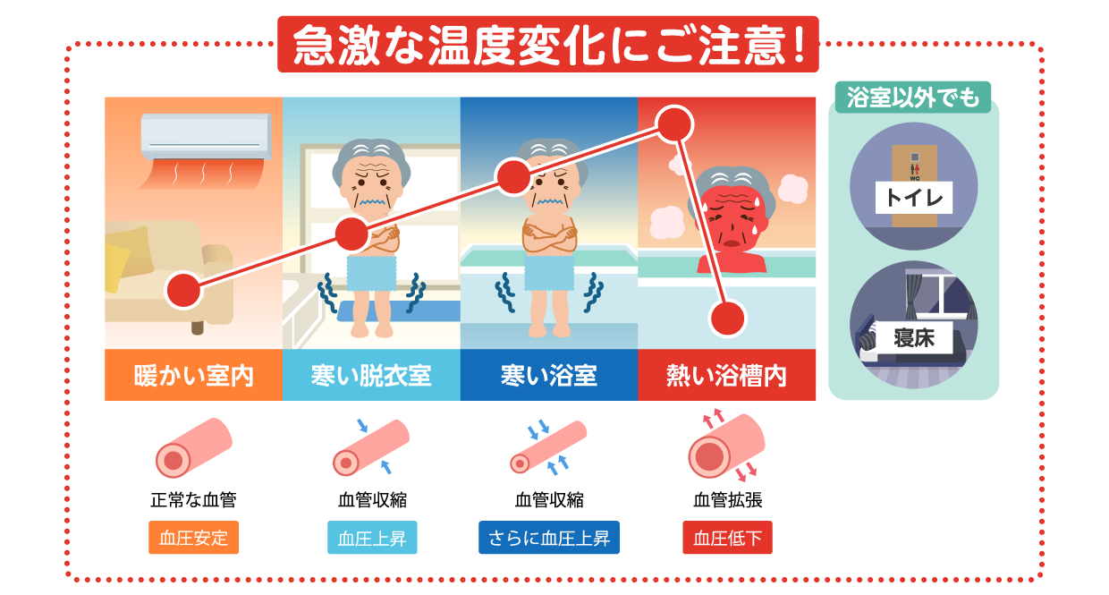 急激な温度変化にご注意