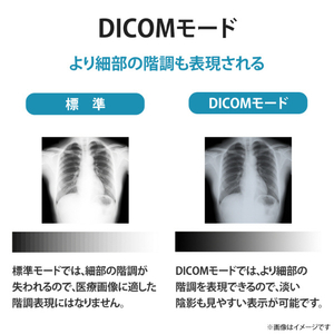 I・Oデータ 27型ワイド液晶ディスプレイ(医用画像参照用) MediCrysta ブラック LCD-MDQ271A-イメージ5