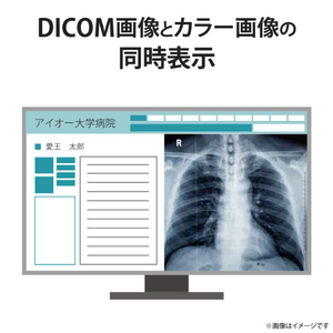 I・Oデータ 27型ワイド液晶ディスプレイ(医用画像参照用) MediCrysta ブラック LCD-MDQ271A-イメージ6
