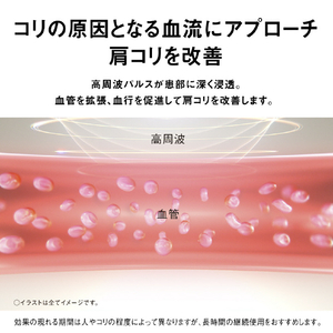 パナソニック 高周波治療器 コリコランループ ブラック EW-RA520-K-イメージ5