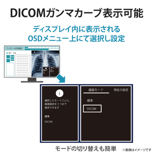 I・Oデータ 27型ワイド液晶ディスプレイ(医用画像参照用) 抗菌モデル 受注生産品 MediCrysta ブラック LCD-MDQ271A-AG-イメージ4
