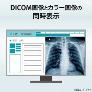 I・Oデータ 23．8型液晶ディスプレイ LCD-MD241D-イメージ6