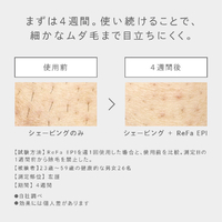 ReFa エピ RE-BA-00A ヨドバシ.com - リファ ReFa 光美容器 ReFa EPI（リファ エピ