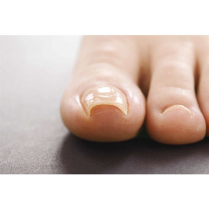 コジット 巻爪ガードテープ(20枚入) ﾏｷﾂﾞﾒｶﾞ-ﾄﾞﾃ-ﾌﾟ20ﾏｲｲﾘ-イメージ2