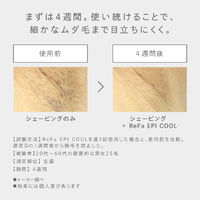 MTG RE-BD-02A ReFa EPI COOL ReFa |エディオン公式通販