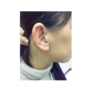 名優 聴覚保護具クオリネ ブルー フリー(6～9φ)ブルー FC099FU-8192452-イメージ3