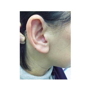 名優 聴覚保護具クオリネ ピンク フリー(6～9φ)ピンク FC101FU-8192454-イメージ3